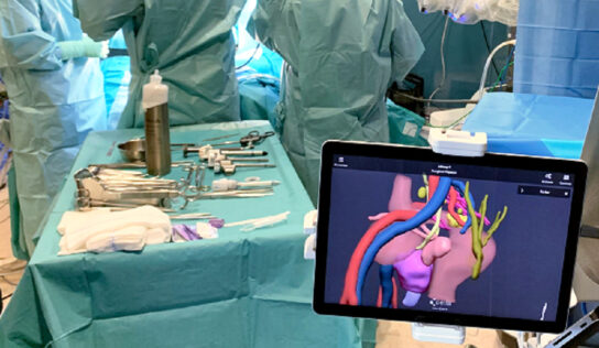 La tecnología 3D reduce las complicaciones en cirugías de cáncer de colon