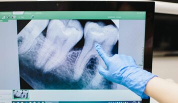«Cada vez hay más evidencia de que la enfermedad periodontal, una inflamación crónica de las encías, puede estar relacionada con un mayor riesgo de sufrir infartos o accidentes cardiovasculares», doctor Carlos Mederos