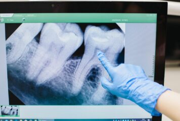 «Cada vez hay más evidencia de que la enfermedad periodontal, una inflamación crónica de las encías, puede estar relacionada con un mayor riesgo de sufrir infartos o accidentes cardiovasculares», doctor Carlos Mederos