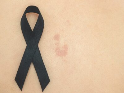 «Exponerse al sol sin protección puede tener consecuencias graves tanto a corto como a largo plazo», explica la dermatóloga Maribel Martínez