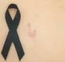 «Exponerse al sol sin protección puede tener consecuencias graves tanto a corto como a largo plazo», explica la dermatóloga Maribel Martínez