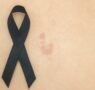 «Exponerse al sol sin protección puede tener consecuencias graves tanto a corto como a largo plazo», explica la dermatóloga Maribel Martínez
