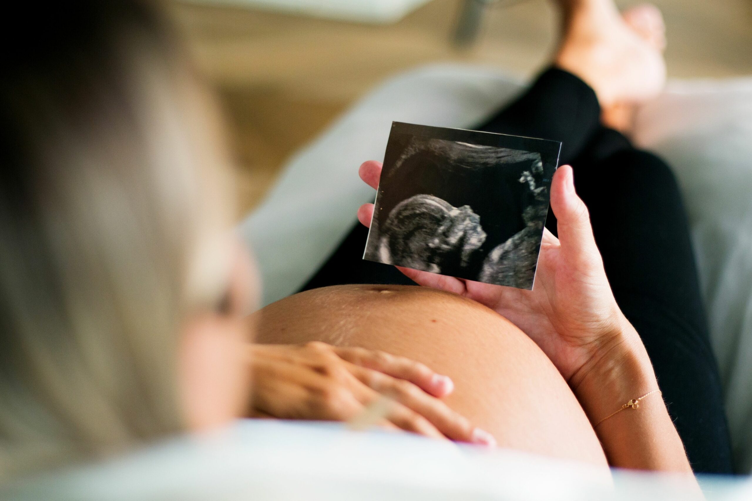 Crecimiento fetal scaled