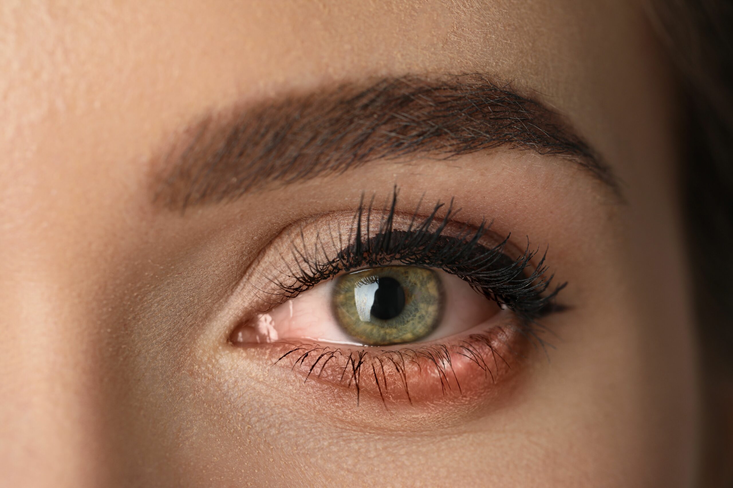 Infeccion ocular scaled