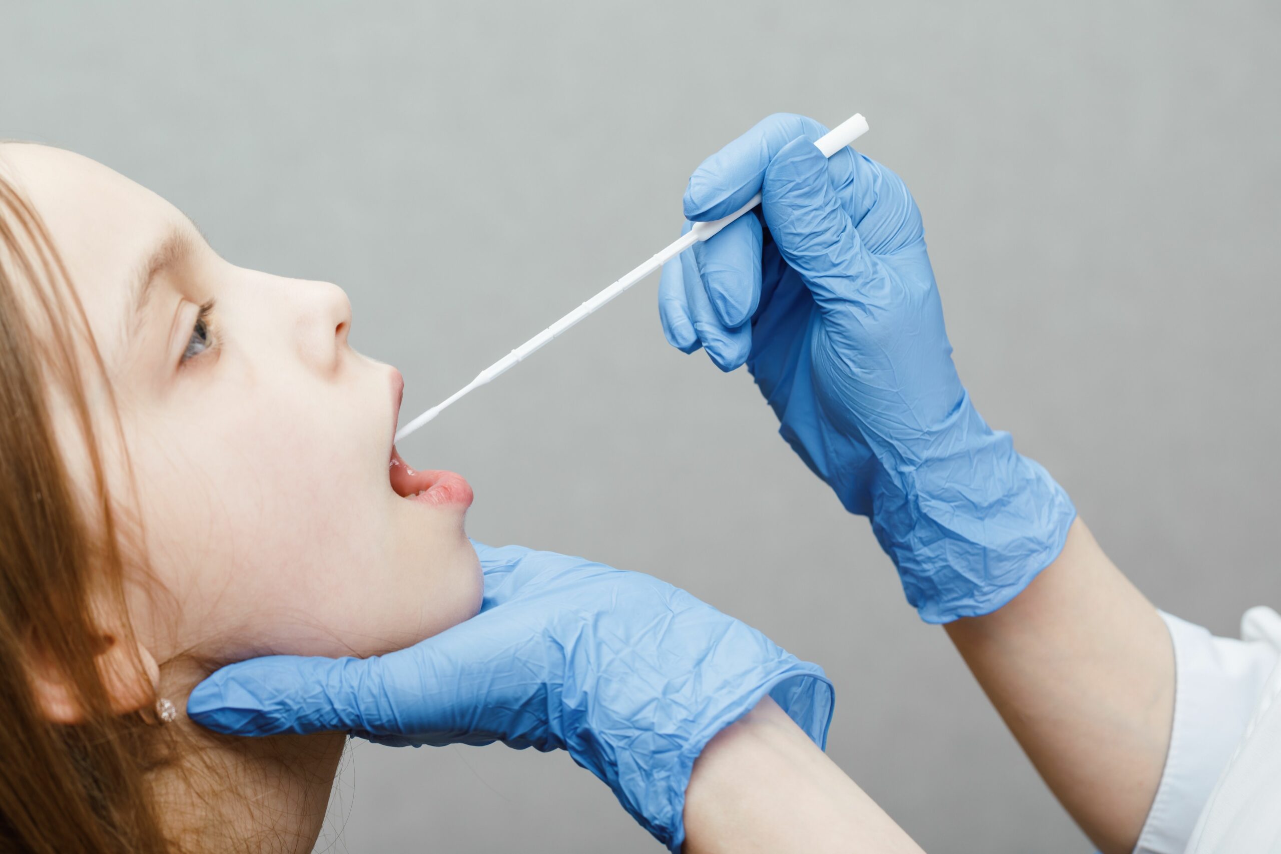 Glandulas salivales scaled