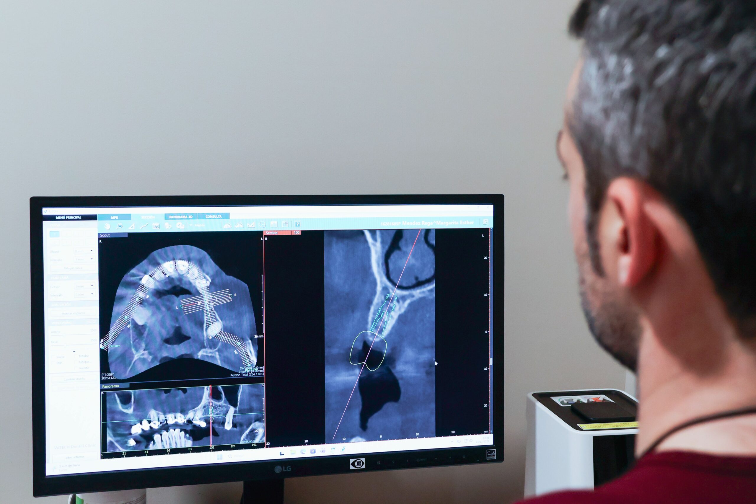 Instituto odontolgico cantbrico 10 scaled