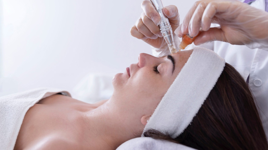 Microneedling Microneedling